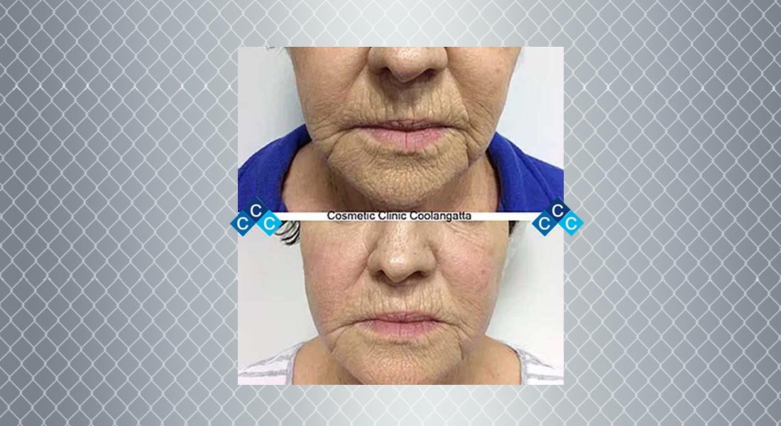 Cosmetic Clinic Coolangatta
