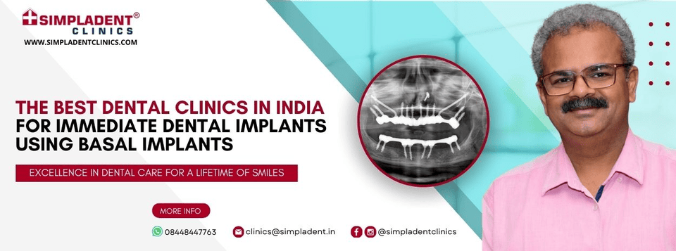 Painless Dental Implants Surgeon