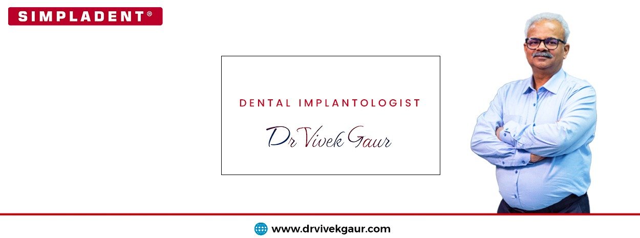 Best Dental Implants in Delhi NCR